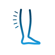 ფეხების შეშუპებული  ვენური უკმარისობით გამოწვეული ფეხების ტკივილის სიმბოლო